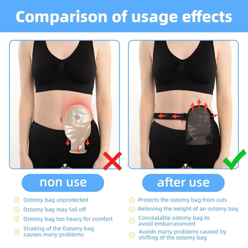 [Australia] - Waterproof Ostomy Bag with Adjustable Fixation Band Reusable Universal Stoma Pouch Cover Ostomy Supplies for ileostomy 1 