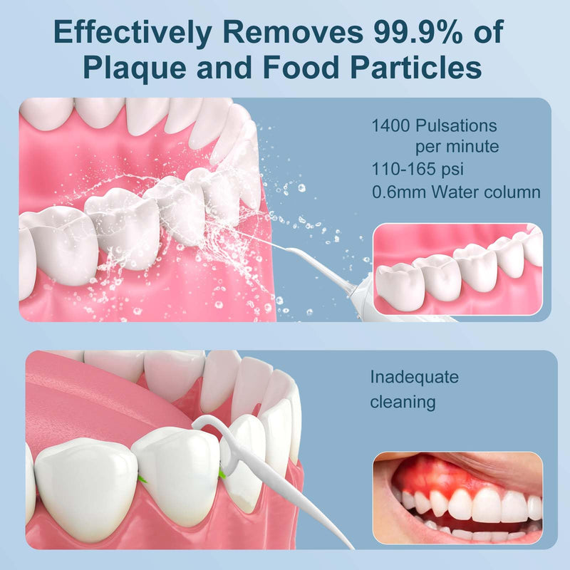 [Australia] - Water Flosser for Teeth Cordless, 300ML Powerful Water Teeth Cleaner Pick Rechargeable Oral Irrigator, 5 Modes Water Dental Flosser Teeth Pick for Teeth Cleaning,Home Use Travel Friendly (White) White 