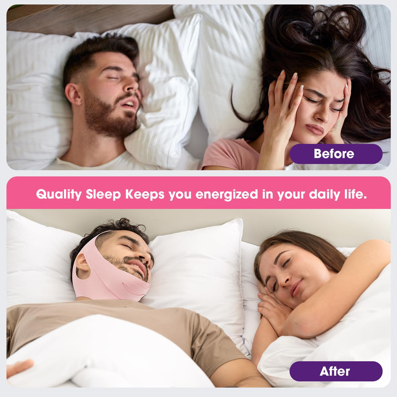 [Australia] - Anti Snore Chin Strap [Upgraded], EasYoung Snoring Solution, Effective Anti Snore Strap, Adjustable and Breathable Material Stop Snoring Sleep Headband for Men Women 