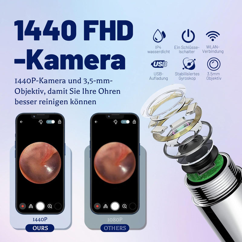 [Australia] - Earwax Remover Ear Cleaner, AMDXD 1440P Wifi Otoscope Camera 8MP HD Ear Camera IP4 Waterproof Ear Mirror 3.5mm Lens Ear Endoscope with 6 LEDs for Adults, Children and Pets, White 