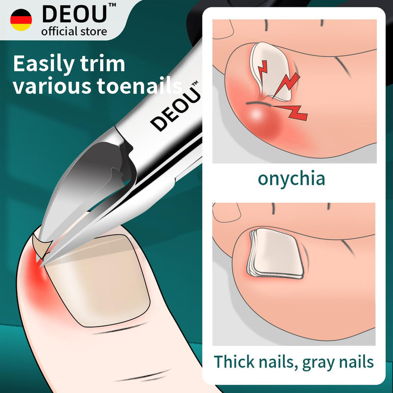 DEOU Toenail Clippers Blade for Ingrown and Thick Nails Stainless Steel Pedicure Tools at Home ingrown toenail Treatment Professional Podiatrist Nail Clippers with Upgraded Handle (Eagle Beak Pliers) Eagle Beak Pliers