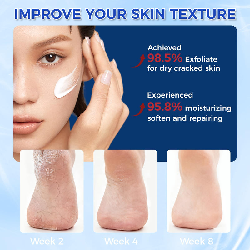 OUKEYA 42% Urea Cream for Dry Rough Skin, Contain Nano Glass Foot File | 3 Oz Tube, 2% Salicylic Acid, Moisturize Lotion, Exfoliating, Heels Care, Hands, Elbows Knees, Softening, Non-Greasy 3 Ounce with Foot File
