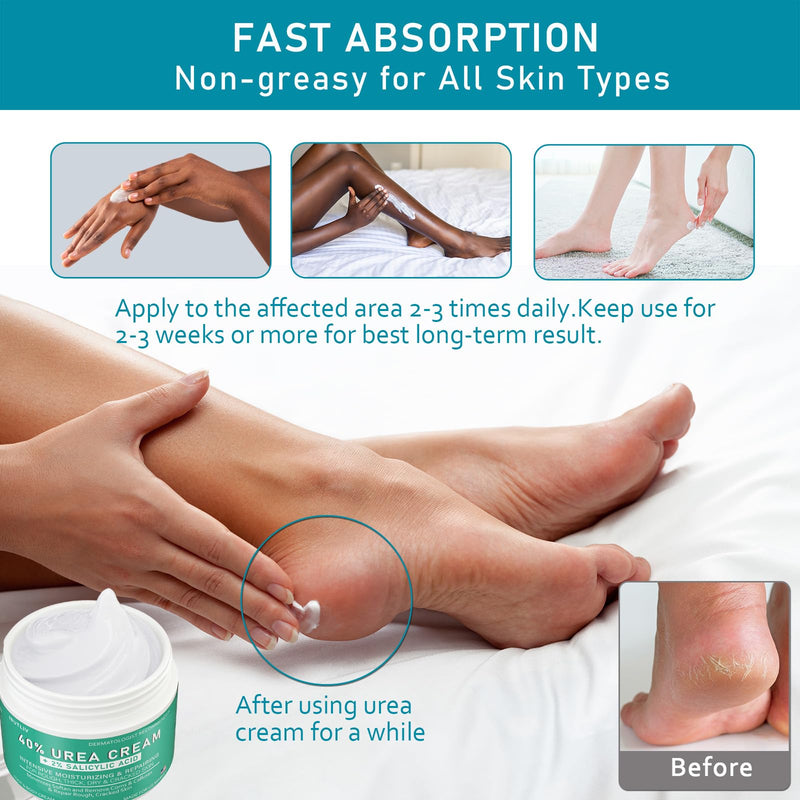 [Australia] - Urea Cream 40 Percent For Feet Maximum Strength - plus Salicylic Acid 2% Foot Cream For Dry Cracked Heels Feet Knees - Dead Skin Cuticle Callus Remover Toenail Softener - Pack of 2 2.65 Ounce (Pack of 2) 