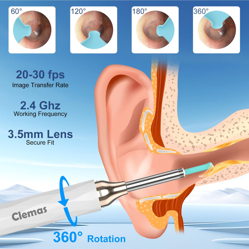 [Australia] - Earwax Remover Otoscope, 1296P HD WiFi Ear Cleaner Camera, IP67 Waterproof, 6 LED Lights, 3.5mm Lens, 360° Wide Angle, Compatible with iPad and Android 