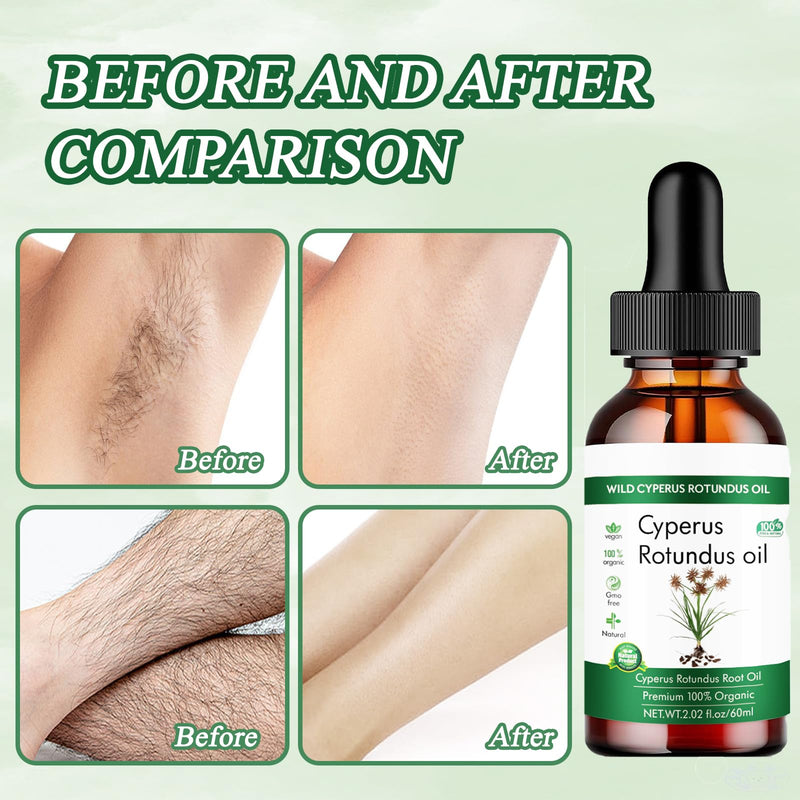 [Australia] - Cyperus Rotundus Oil Cyperus Rotundus Oil Pure Cyperus Oil Cyperus Rotundus Oil Hair Removal For Reducing Hair Growth Smooth Skin & Hair Removal Moisturizing & Soothing 