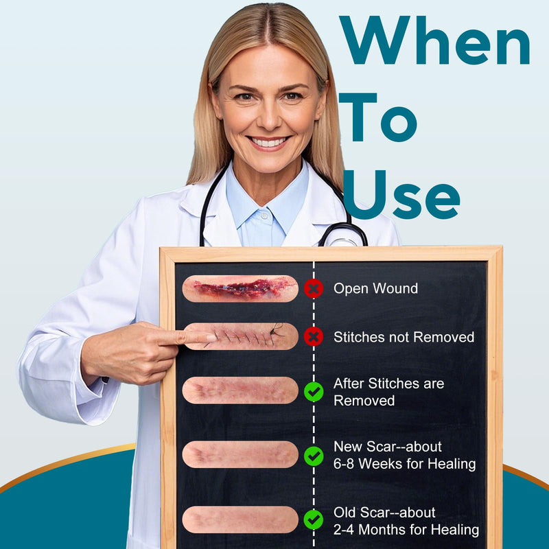 [Australia] - Silicone Scar Sheets, Silicone Scar Tape, Reusable Scar Silicone Strips for Scar Removal Treatment, Soft Silicone Scar Sheets for Surgical Scars, Keloid, C-Section, Burn et(1.6‚Äù x 59‚Äù Roll-1.5M) 1.5M 