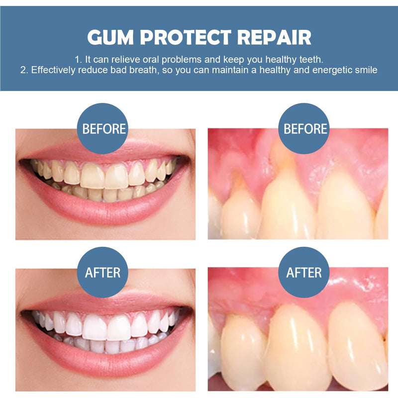 [Australia] - Gum repair gel, gum growth gel, natural oral care gel, gum gel, gum growth gel, gum therapy gel, tooth whitening pen, gum care gel 
