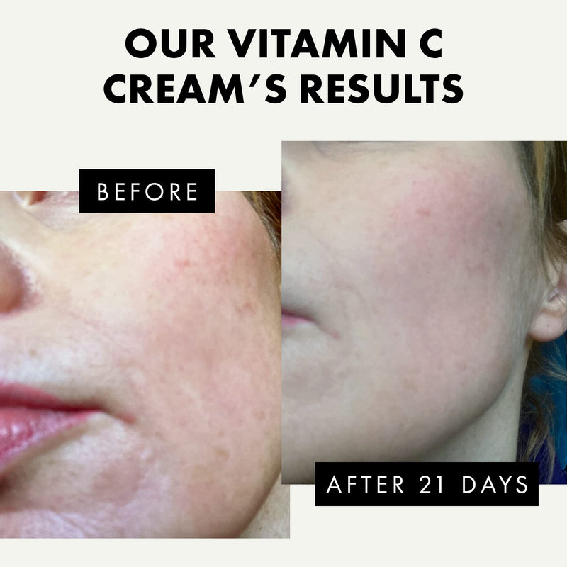 Eclat Skincare Vitamin C Moisturizer for Face with Hyaluronic Acid & Squalane - Face Brightening Cream - Anti Aging, Firming & Hydrating Vitamin C Cream for All Skin Tone 50 ml Brightening Vitamin C Cream