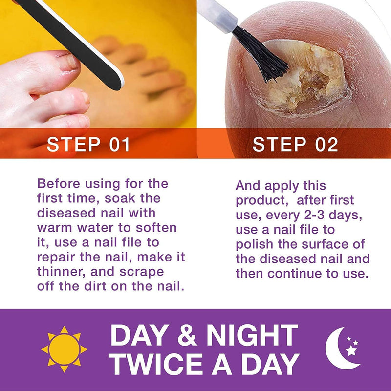 [Australia] - Toenail Fungus Treatment Extra Strength for Toenails and Fingernail Discoloration 1.0 Oz Drop 1 Fl Oz (Pack of 1) 