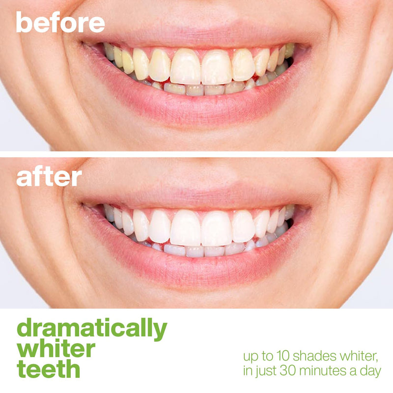 [Australia] - AquaSonic Professional Teeth Whitening Strips - Enamel Safe Teeth Whitening with Hydrogen Peroxide - Easy to Use, Non-Slip, Affordable & Effective (Spearmint) Spearmint 