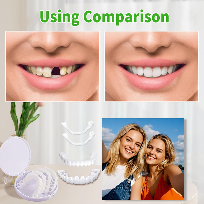 [Australia] - Temporary Veneers Kit for Women and Men, Tooth Replacement Kit, Nature and Comfortable (1 Count (Pack of 1), Natural)-0A01 