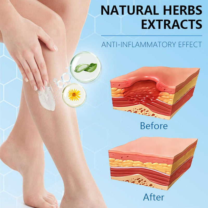 [Australia] - Zoencgz Bee Venom Treatment Cream, Bee Venom Cream for Treating Arthritis and Varicose Veins, Bee Venom Cream, Hydrating Moisturizing Treatment Cream for Men & Women (2PCS) 