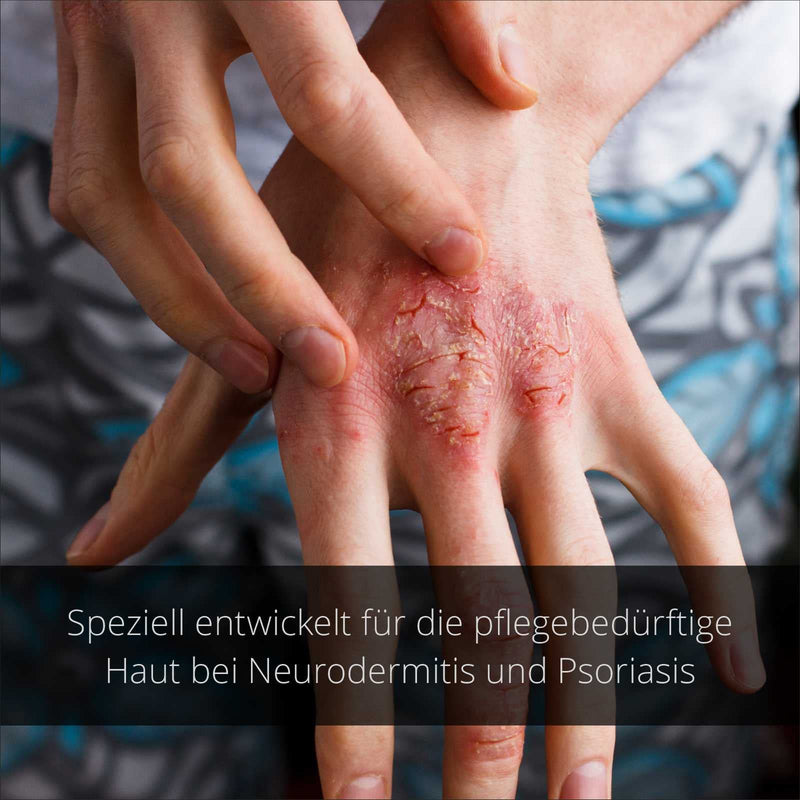 [Australia] - Natural Products Black - NeuroPsori Special Care Cream for Psoriasis/Psoriasis and Neurodermatitis, 50ml 50ml (Pack of 1) 