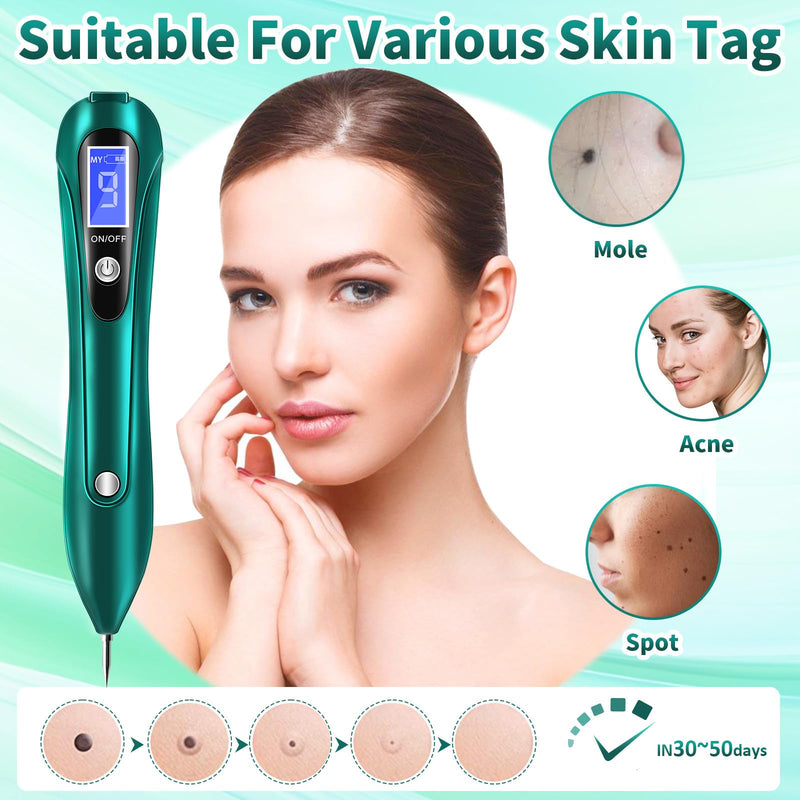 [Australia] - CHRERNA Plasma Pen device for hand and body (warts, birthmarks, nevus, birthmarks, pigment spots, age spots) green 