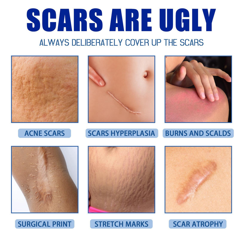 [Australia] - Scar Cream,Scar Removal Cream,Silicone Scar Gel,Scar Silicone Gel,Scar Gel,Scar Cream for Surgical Scars, Stretch Marks and Keloid Bump (1pcs) 1pcs 