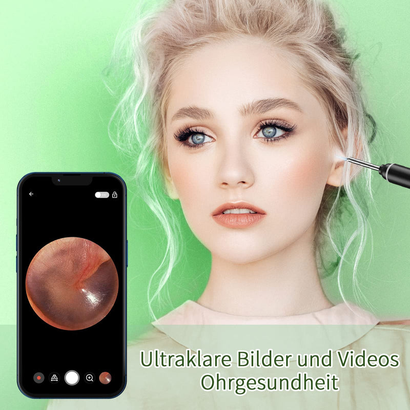 [Australia] - Earwax Remover Otoscope, VITCOCO 1920P Wifi Ear Cleaner, Ear Cleaner with Camera, Otoscope with 6 LEDs for iPhone, iPad and Android Smartphones, Black 