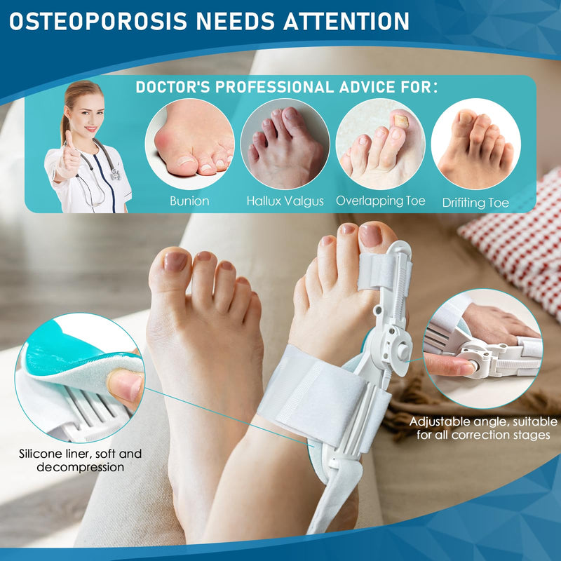 [Australia] - Baby Molove Hallux Valgus Correction, Adjustable Button Hallux Valgus Splint Bunion, Elastic Bunion Corrector, Hallux Valgus Bunion Correction White 