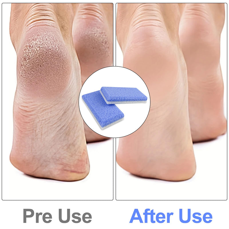 [Australia] - Rseuphiee Pack of 2 double-sided pumice stone feet, pumice stone for feet, foot peeling stone, pumice stone foot care, callus remover, for hard skin on feet and body peeling pedicure tools 