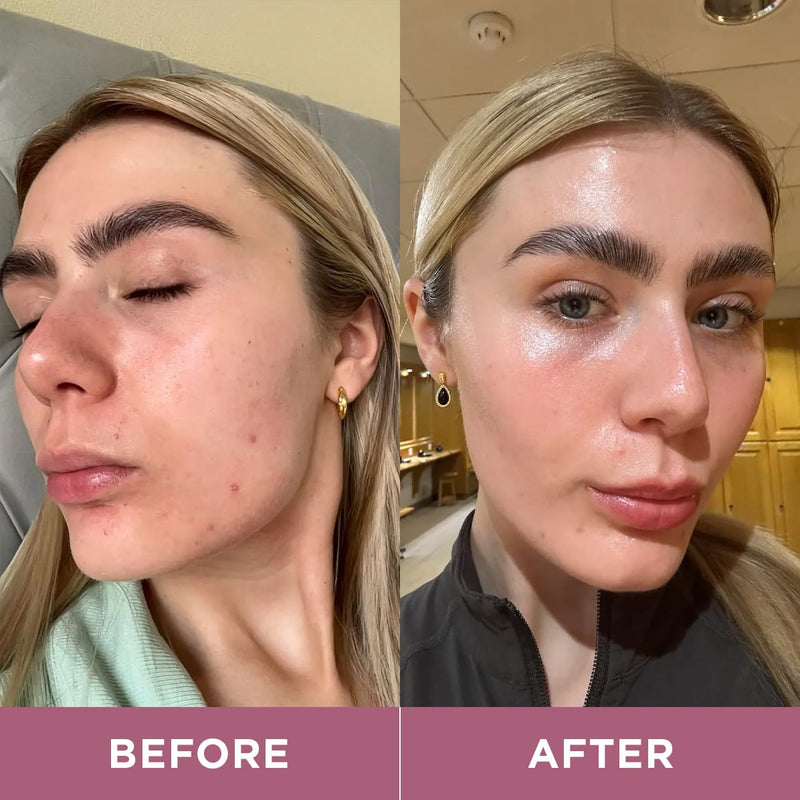 Revive Collagen Enhanced Plus 10,000mg Hydrolysed Marine Collagen Drink with Added Vitamin A & C for Healthy Skin, Hair, Nails & Joints | Tropical Flavour | 14 x Sachets 14 x Eco box