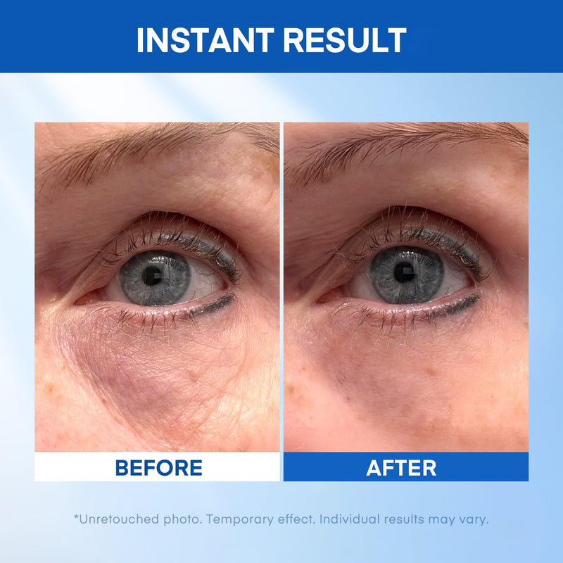 [Australia] - Instant Under Eye Lift Serum - Reduces Eye Bags, Wrinkles, Puffy Eyes, Dark Circles & Crow‚Äôs Feet in Minutes - Advanced Firming Polysaccharide Formula for Mature Skin - 20 mL 0.68 Ounce (Pack of 1) 