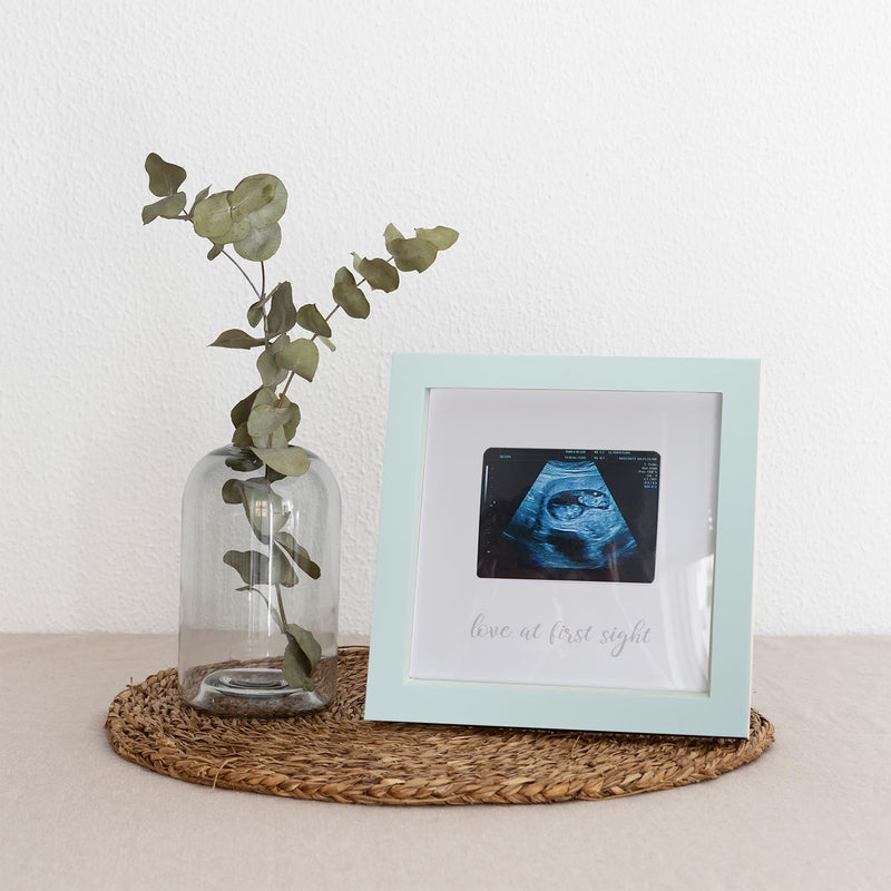 [Australia] - Love at First Sight Ultrasound Picture Frames, Sonogram Picture Frame, Pregnancy Announcement for Grandparents, Baby Announcement Ideas Ultrasound Photo Frame Nursery Décor, White Love at First Sight - White 