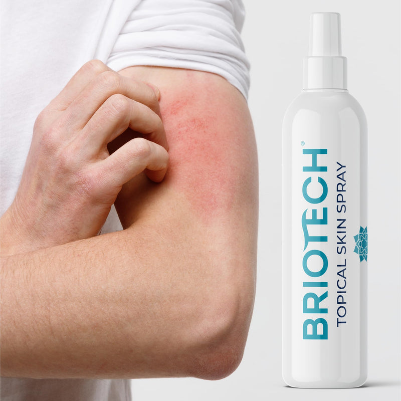 [Australia] - BRIOTECH Topical Skin Spray, Hypochlorous Acid Spray for Body & Face, Eyelid Cleanser, HOCl Facial Mist, Support Against Irritation, Calm Redness, Soothe Foot & Scalp, Packaging May Vary, 3.4 oz, 1 ct 3.4 Fl Oz (Pack of 1) 