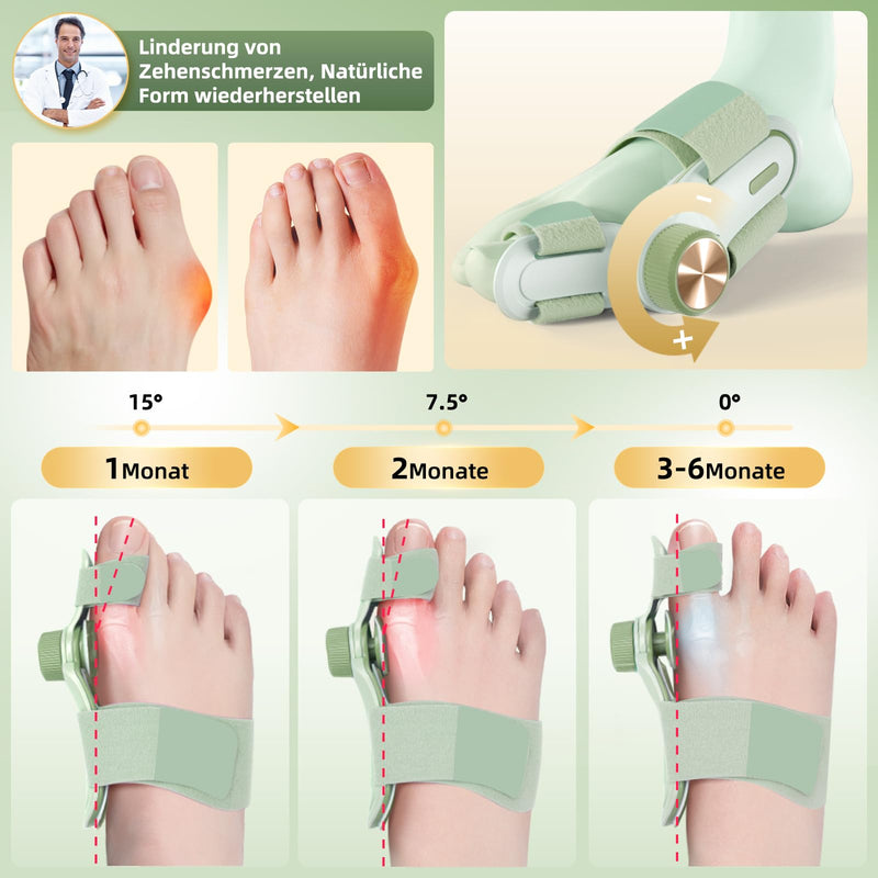 [Australia] - TENICORE Hallux Valgus Correction Adjustable Button, Hallux Valgus Splint with 3 Chioces of Angle Mounting Plates, Hallux Valgus Toe Separator for Medium/Heavy Bunion Green 