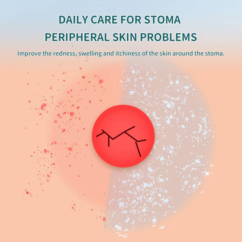 [Australia] - Stoma Powder，Protects Skin Keep Dry Ostomy Powder (2 Bottles) 2 Bottles 