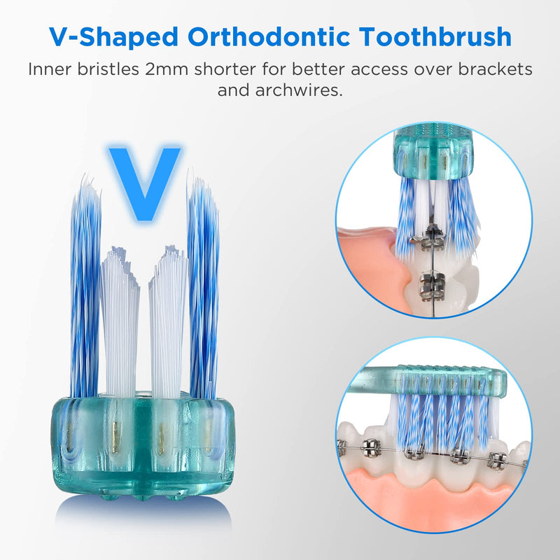[Australia] - V-Shaped Orthodontic Toothbrush for Braces, with 6 Interdental Brushes, Soft Bristles, 6 Count V Shaped (w/ Interdental Brushes) 