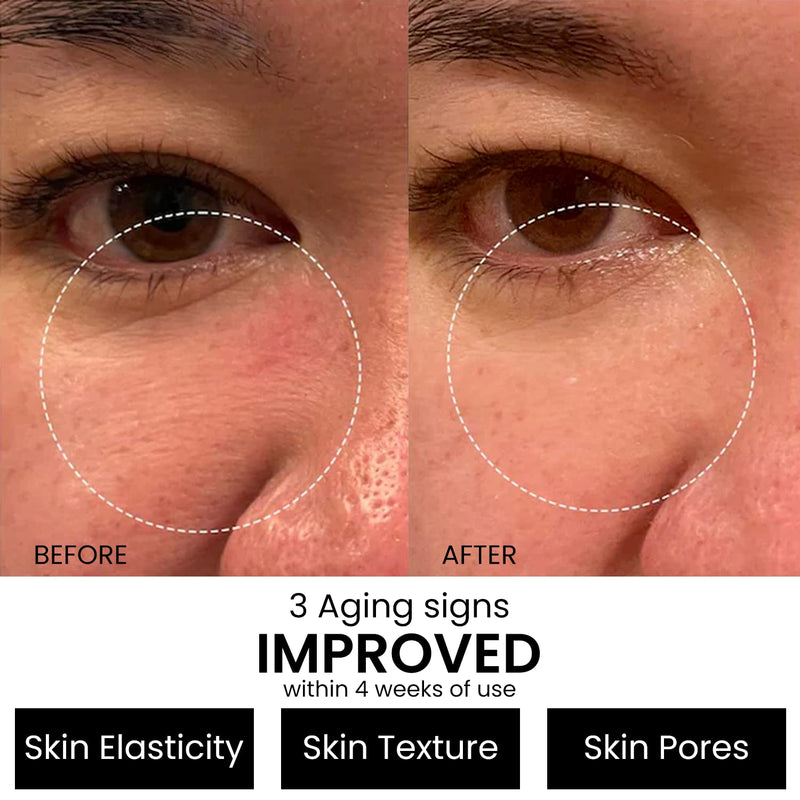 Kleem Retinol Serum 2.5% for Face Anti-Aging Serum with Hyaluronic Acid to Minimize Wrinkles. Improves Sun Damaged Skin and Fades Uneven Skin Tones - Vitamin A Serum (1oz)
