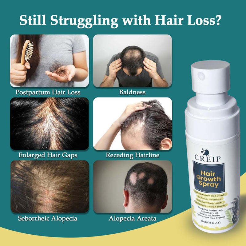 Natural Hair Growth Oil Spray: Natural Formula with Batana, Castor and Rosemary Oil, Rice Water, and Biotin for Women and Men