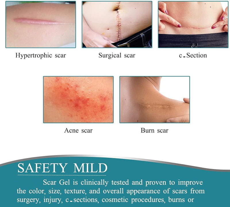 [Australia] - Medical Grade Silicone Scar Sheets, Silicone Scar Tape (1.6”x 120”), Professional Scar Removal Treatment, Reusable Silicone Scar Strip for Keloid, C-Section, Surgery, Burns, Acne Etc 