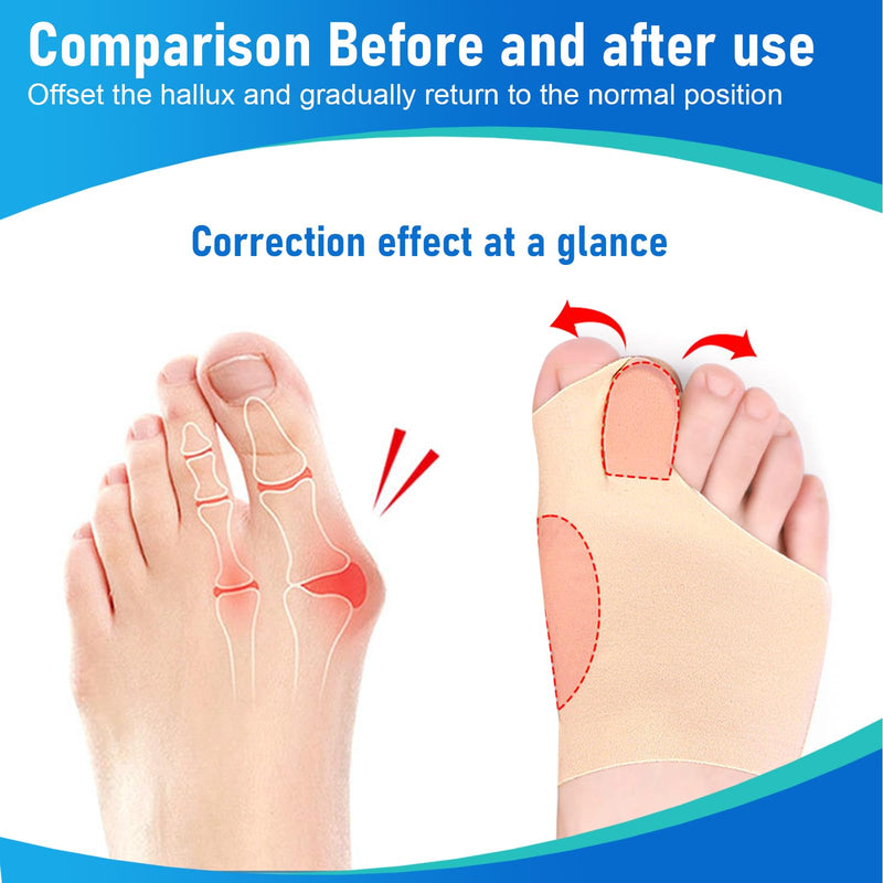 [Australia] - TCASENER Hallux Valgus Correction Bandage, Hallux Socks, Toe Separator Hallux Valgus Correction Washable, Silicone Bandage Toe Spreader Hallux Valgus for Men and Women MWFJIAOT01 