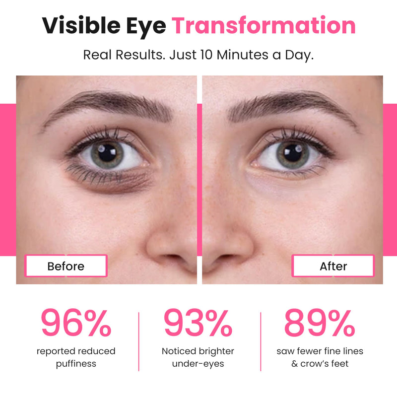 [Australia] - Eye Revitalize – Red Light Therapy for Dark Circles & Eye Bags 