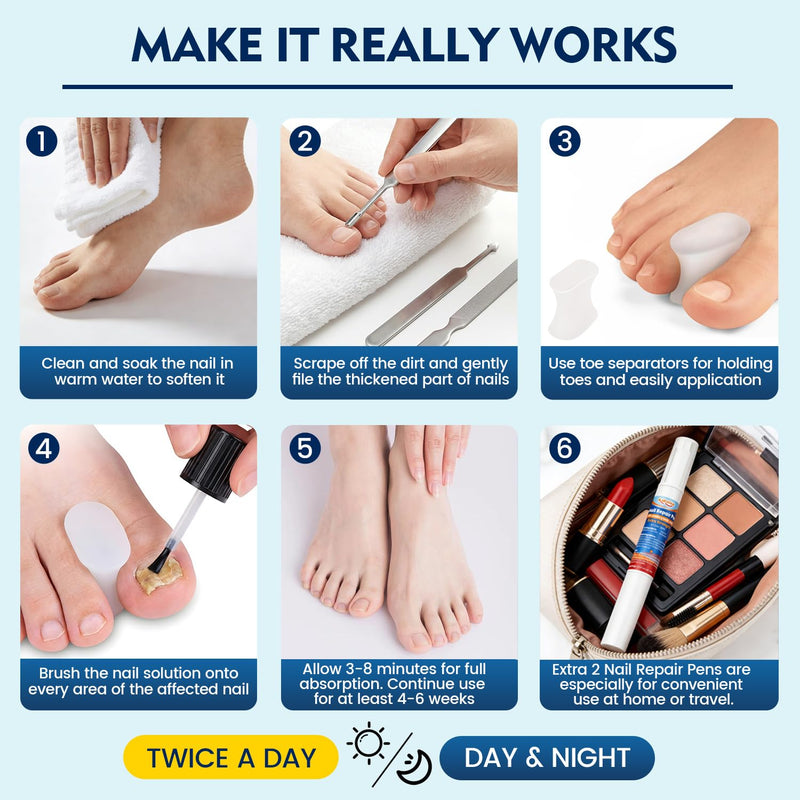 Toenail Fungus Treatment Extra Strength, Nail Fungus Treatment for Thick, Discolored Fungi Nails - 25% Undecylenic Acid All-in-One Kit with 30ML Fungi Nail Solution, 2 Nail Repair Pens