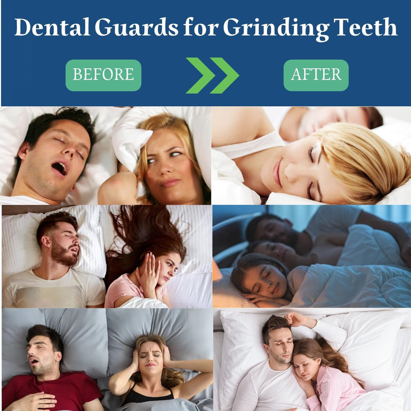 [Australia] - Mouth Guard for Clenching Teeth at Night, 4 Pcs Night Guards for Teeth Grinding, Professional Dental Guards for Grinding Teeth, Moldable Mouthguards for Grinding of Teeth, Teeth Grinding Guard Matte White 