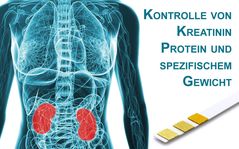 [Australia] - One+Step kidney test 5 pieces - urine test strips to control creatinine, protein and specific gravity 