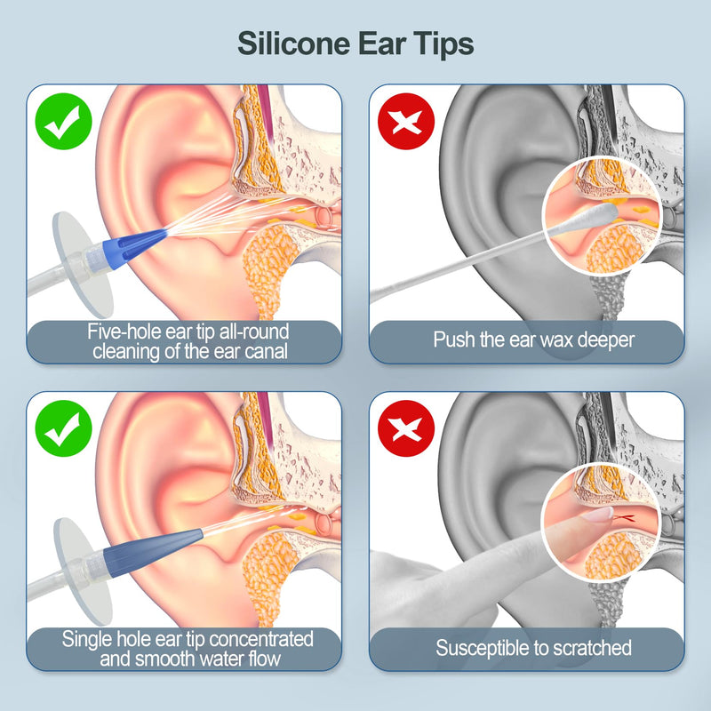 [Australia] - Ear Wax Removal Kit, Ear Cleaning Kits Manual Safe Ear Irrigation Flushing System, Effective Ear Cleaner Earwax Removal Kit, Ear Wax Removal Tool with Ear Basin and 10 Ear Tips 