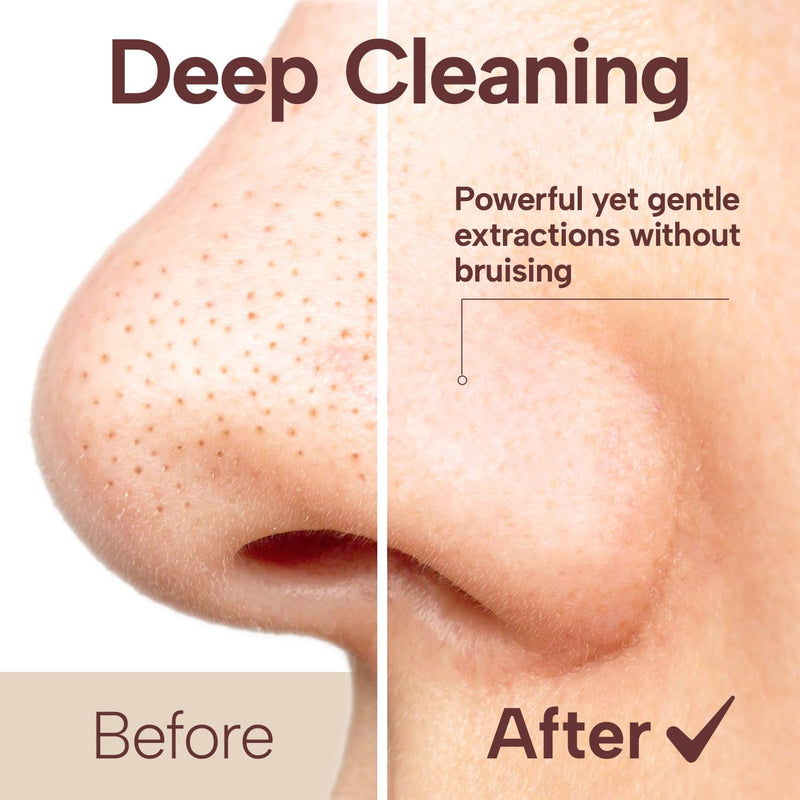 Blackhead Remover Vacuum with Camera Pore Vacuum, Black Head Extractions and Pore Cleaner, 3 Adjustment Modes & 3 Suction Heads