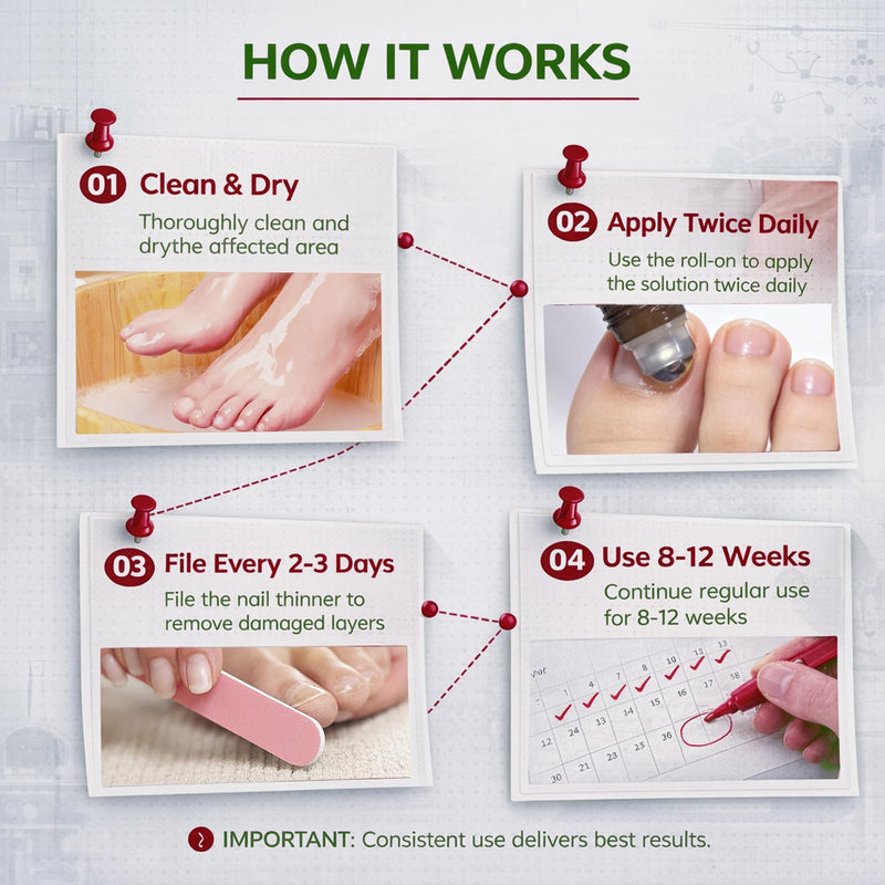 Toenail Fungus Treatment Extra Strength, 1% Tolnaftate Antifungal Fungal Nail Treatment, ToeNail Fungus Treatments For Thick Discolored Brittle Crumbling Nails, 0.51 fl oz (Pack of 1)