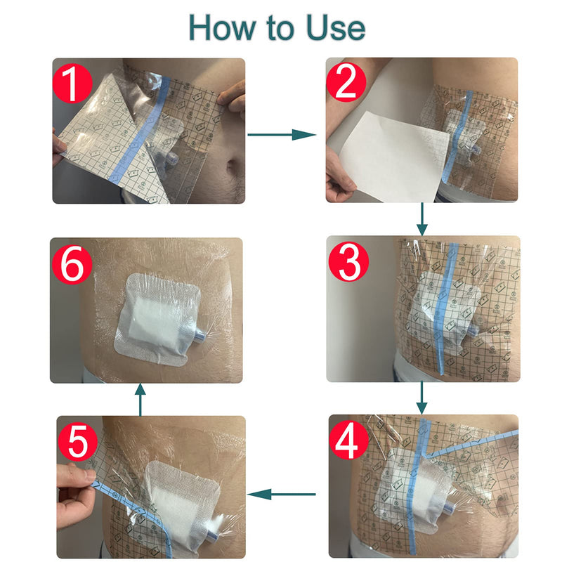 [Australia] - Waterproof Shower Cover Adhesive Bandage Ostomy Stoma Bag Protector Shield Film with Non-Stick Pad for Colostomy Ileostomy Urostomy Water Bath Barrier Men and Women 10"x12" 14Pcs 10x12 Inch (Pack of 14) 