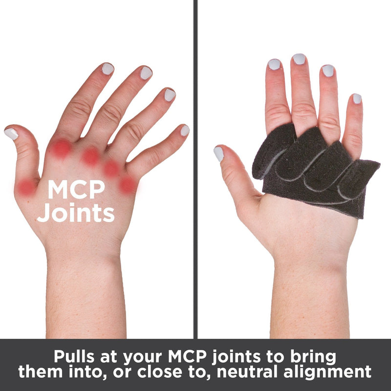 BraceAbility Ulnar Deviation & Drift Hand Splint | MCP Knuckle Joint Support Brace for Rheumatoid Arthritis & Tendonitis Pain Relief, Finger Straightener & Stretcher Glove - S (SM/MED) Left Small Left