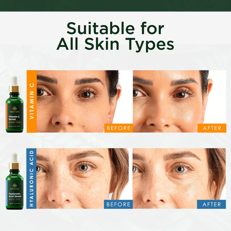 Tree of Life Face Serum Skin Care, Facial Serum for Women and Men, Set of 2 | Hydrating facial serum set. Includes Vitamin C and Hyaluronic Acid serum for brightening and firming.
