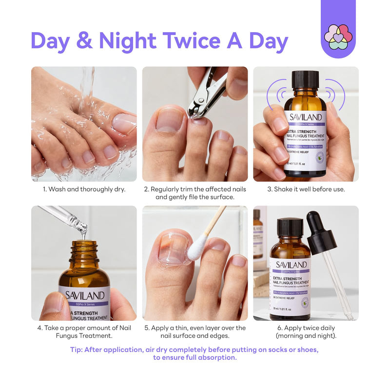 SAVILAND Toenail Fungus Treatment for Thick Discolored Damaged Nails 2oz | FSA-HSA, Max 25% Undecylenic Acid & 1% Tolnaftate, With Salicylic Acid & Vitamin E, Daily At-Home Use, Includes File & Swabs
