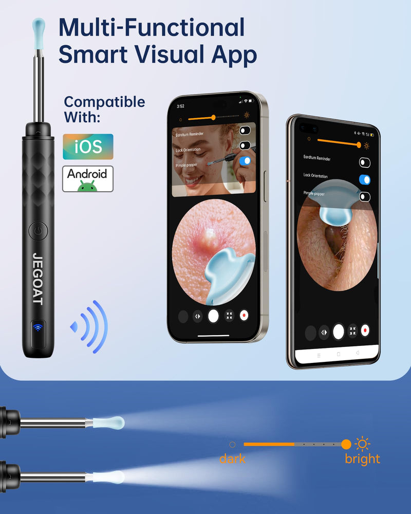 [Australia] - Ear Wax Removal - Ear Cleaner with Camera 1296P HD Ear Scope 6 LED Lights and 10 Pcs Ear Spoon - Earwax Remover Tool Jet Black 