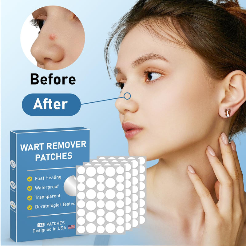[Australia] - Wart Remover Patches, Quick and Effective Hydrocolloid Waterproof Skin Care Stickers for All Kinds of Skin -FM 144 patch 
