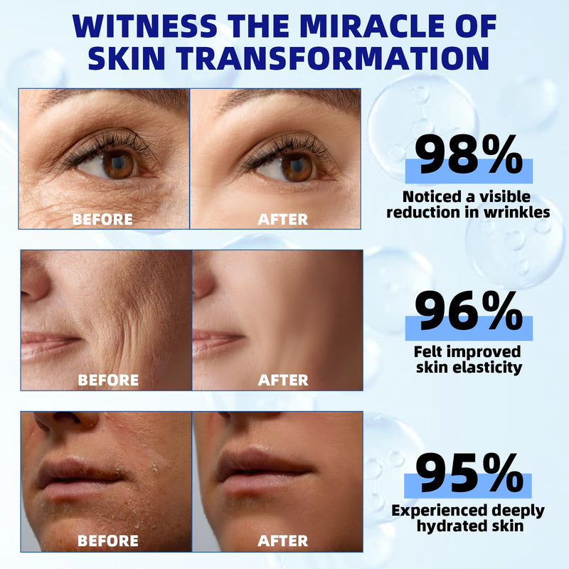 Retinol Serum for Face, 2.5% Retinol Intense Night Serum with Squalane,Vitamin C & E & B3,Hyaluronic Acid for Lines, Wrinkles & Premature Sun Damage to Resurface & Hydrate 30 ml/ 1 Fl oz Retinol Serum for Face