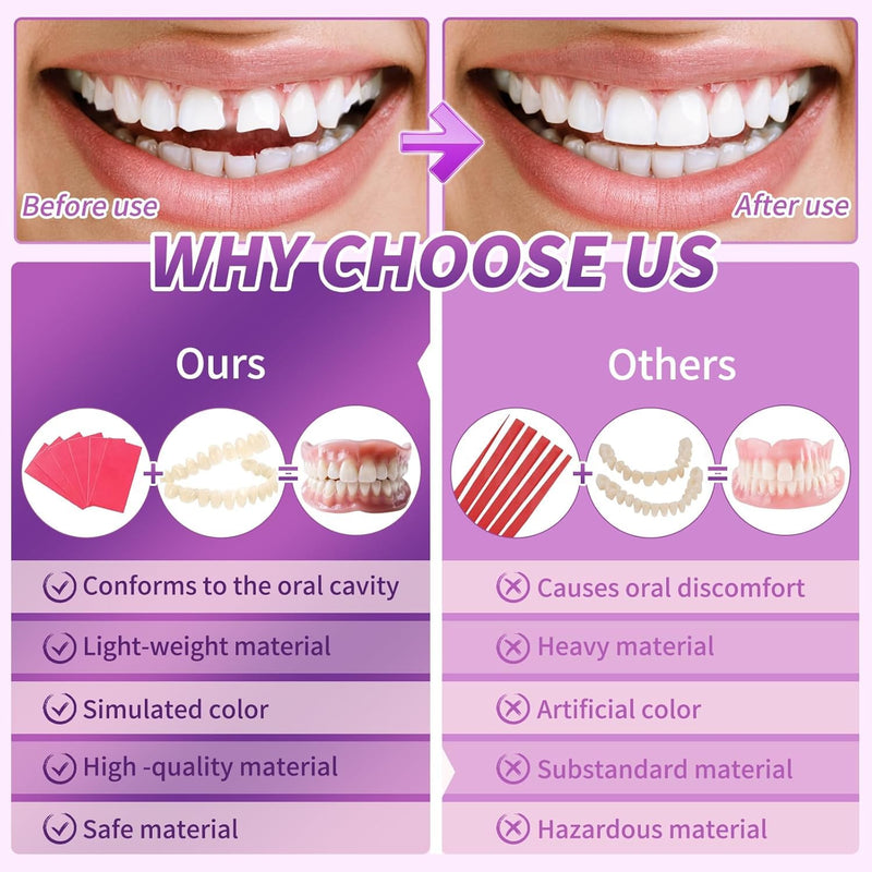 [Australia] - at-Home DIY Denture Kit: Full Set of Upper & Lower False Teeth for DIY Smile Transformation-ZZ2 
