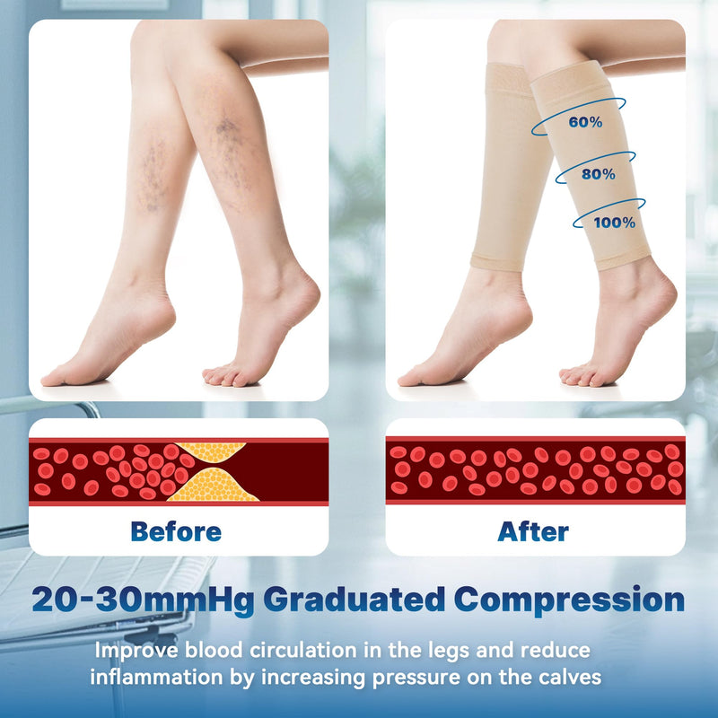 [Australia] - BellaAktion Calf Medical Compression Stockings Women & Men Compression Socks Medical with 20-30 mmHg Graduated Support Thrombosis Stockings Support Stockings for Varicose Veins Edema XL Beige 