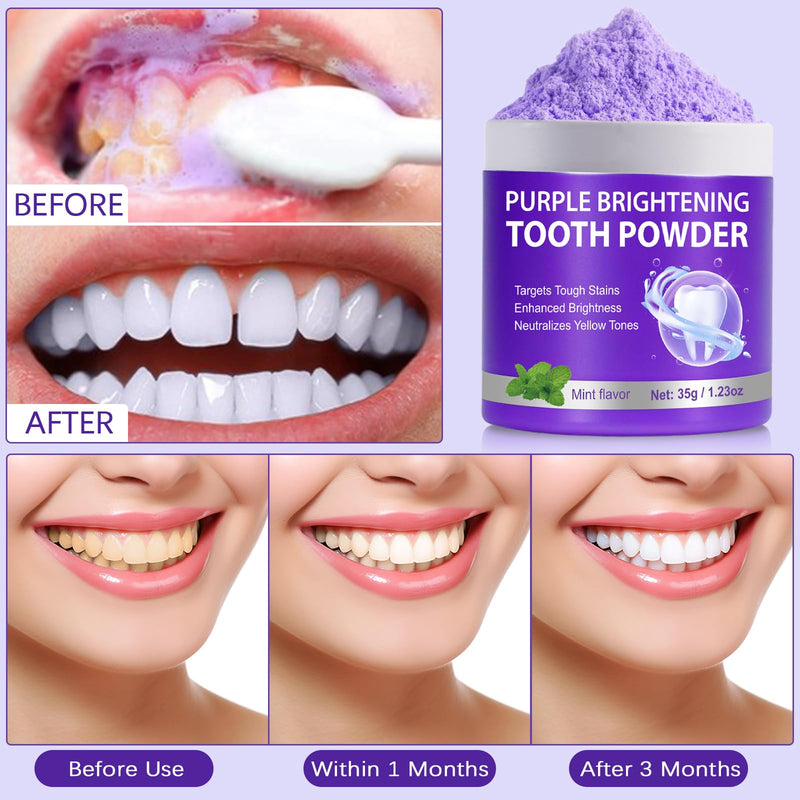 [Australia] - Teeth Whitening Powder, Removes Stains, Teeth Whitening, Toothpaste Whitening Powder for Coffee, Tea, Food, Wine, Keeps Breath Fresh, Promotes Oral Health,No Sensitivity, 35g 